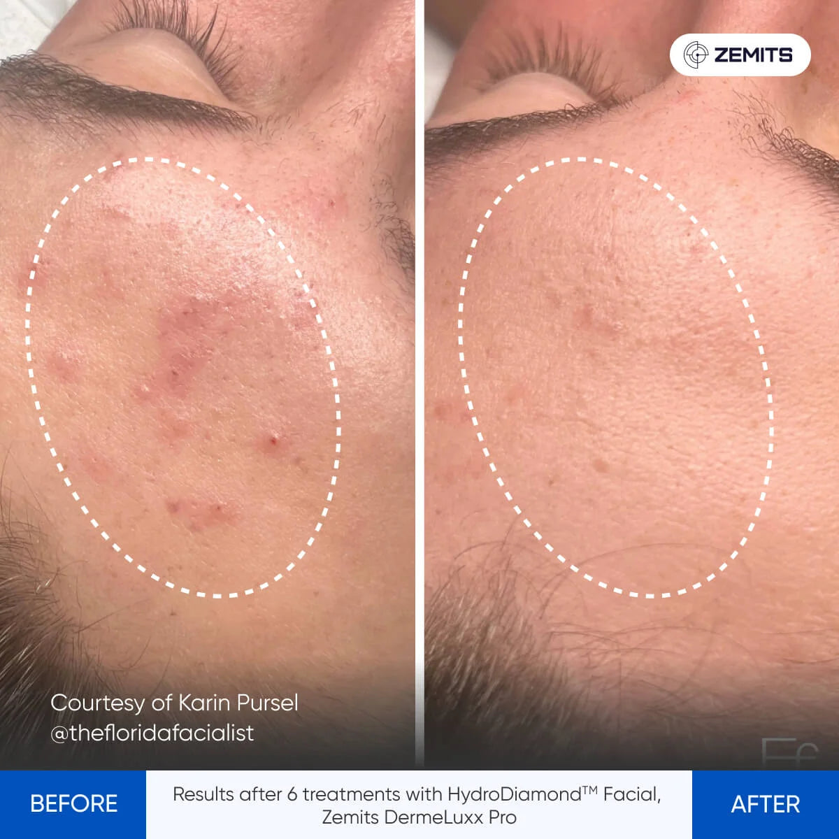 Before After Slide 2
