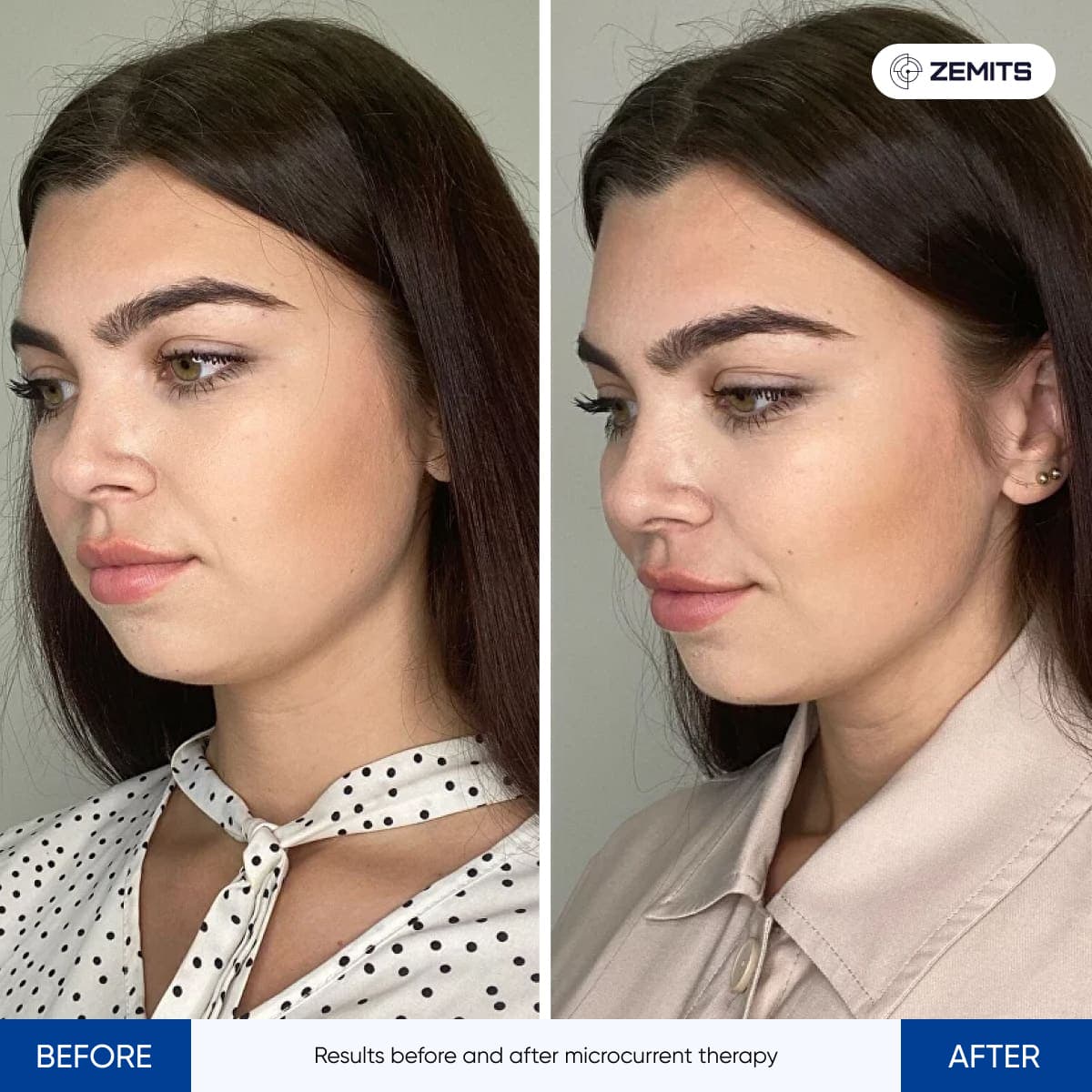 Before After Slide 1