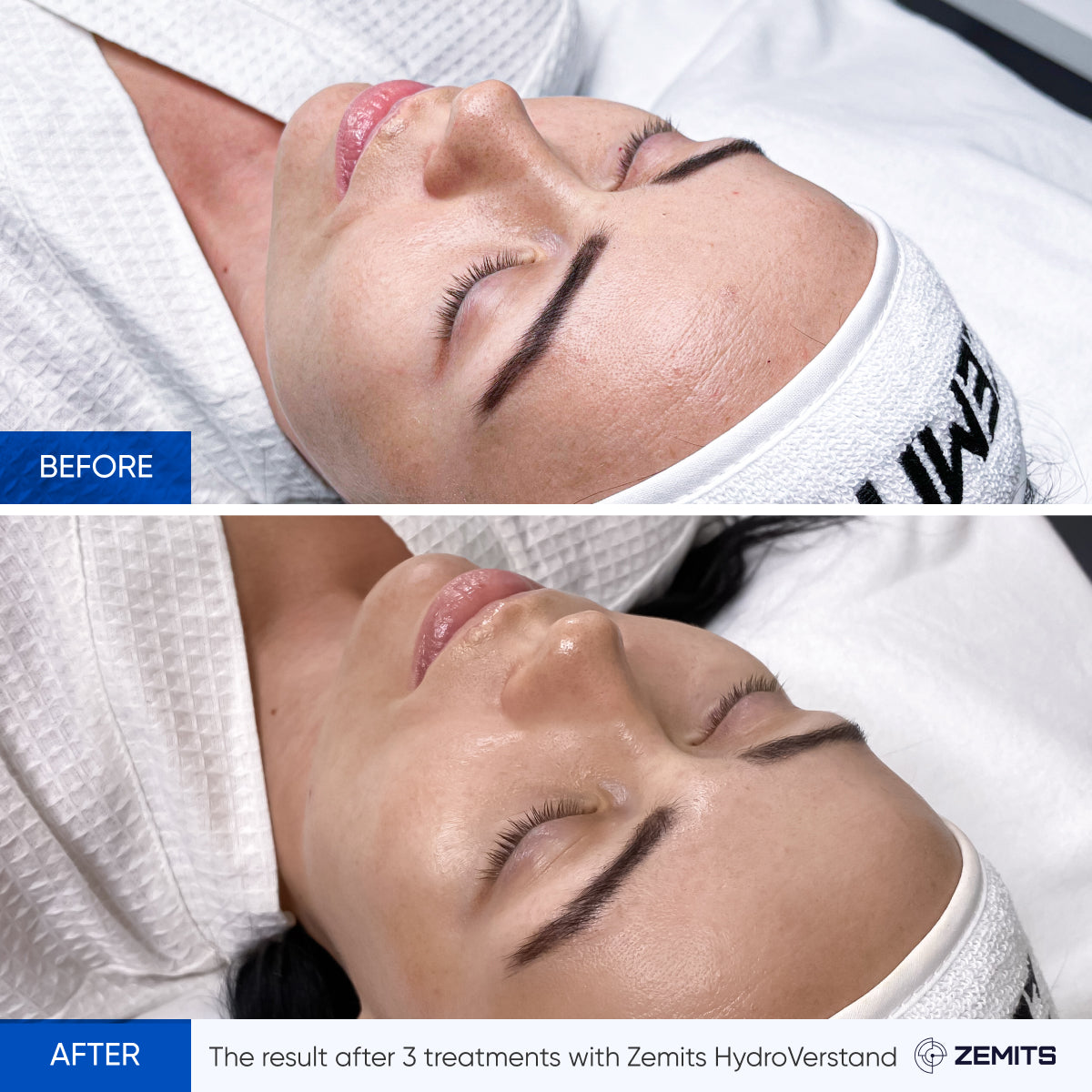 Before After Slide 1
