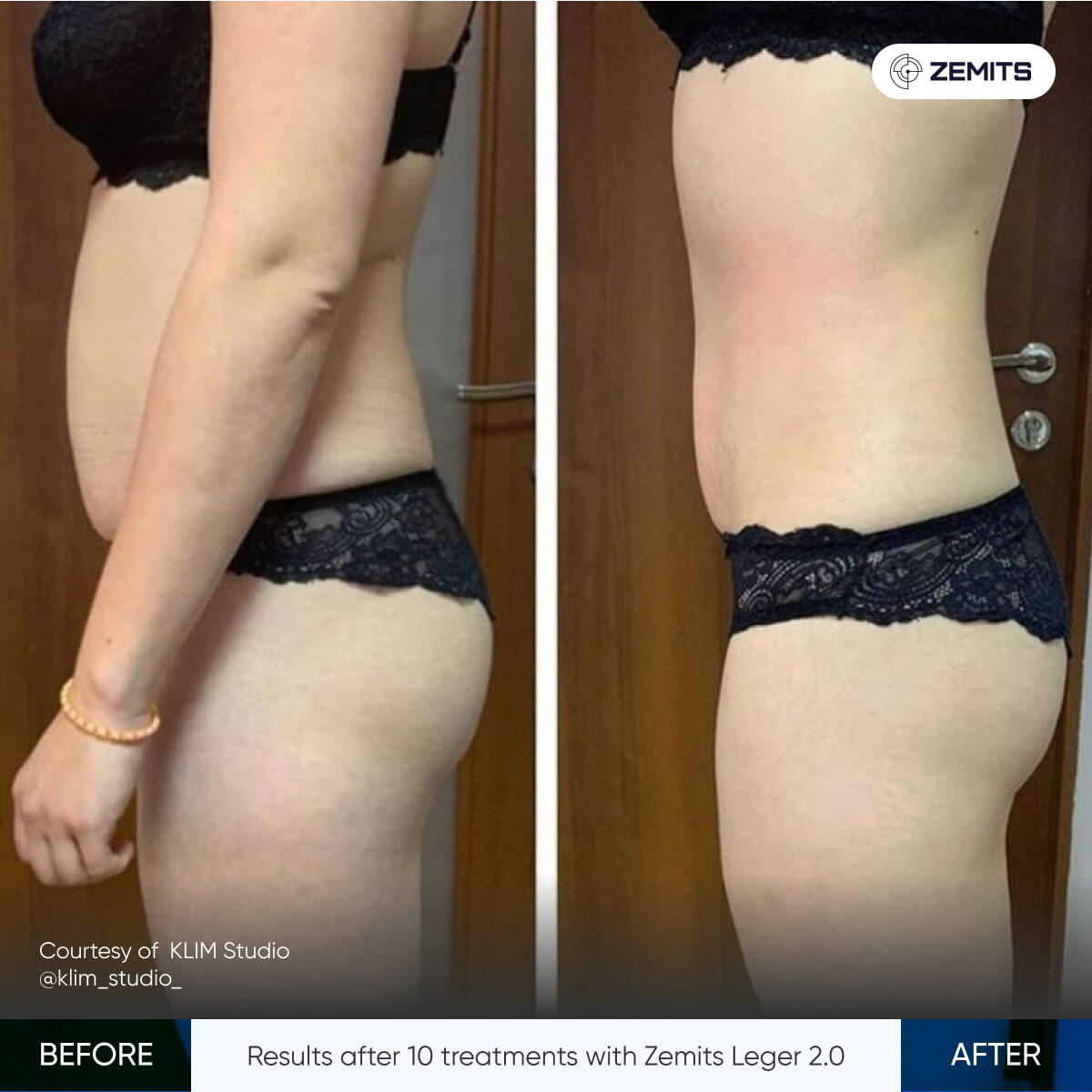 Before After Slide 6