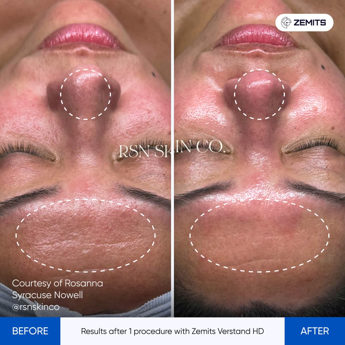 Before After Slide 7