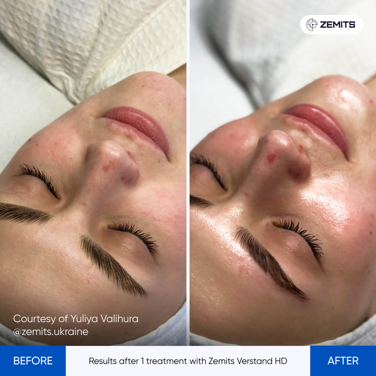 Before After Slide 4