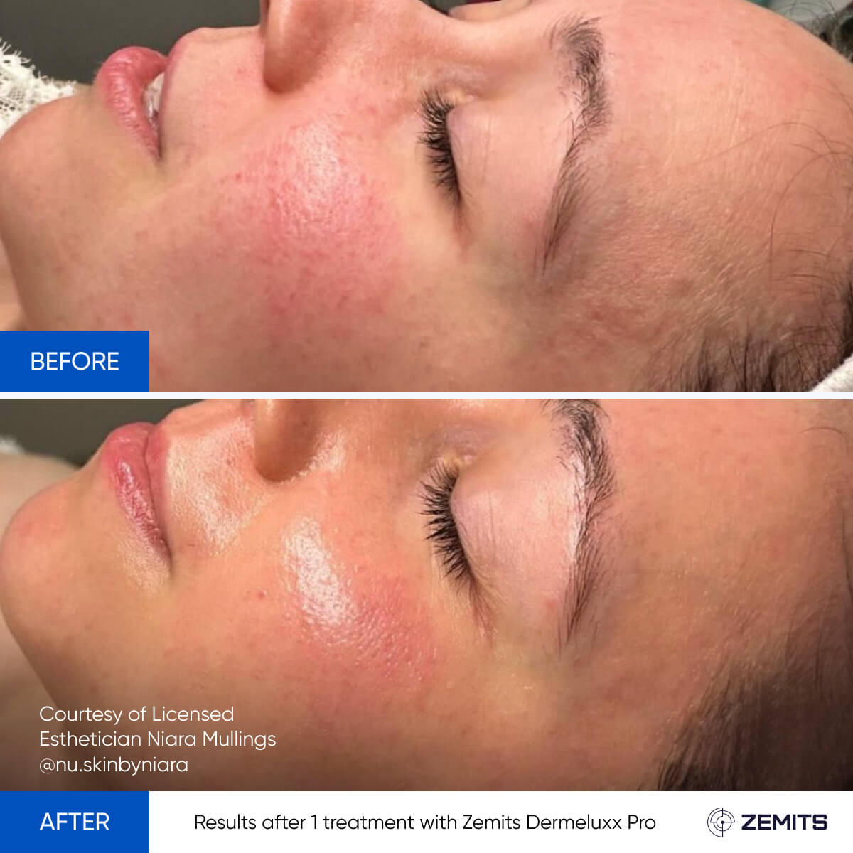 Before After Slide 20
