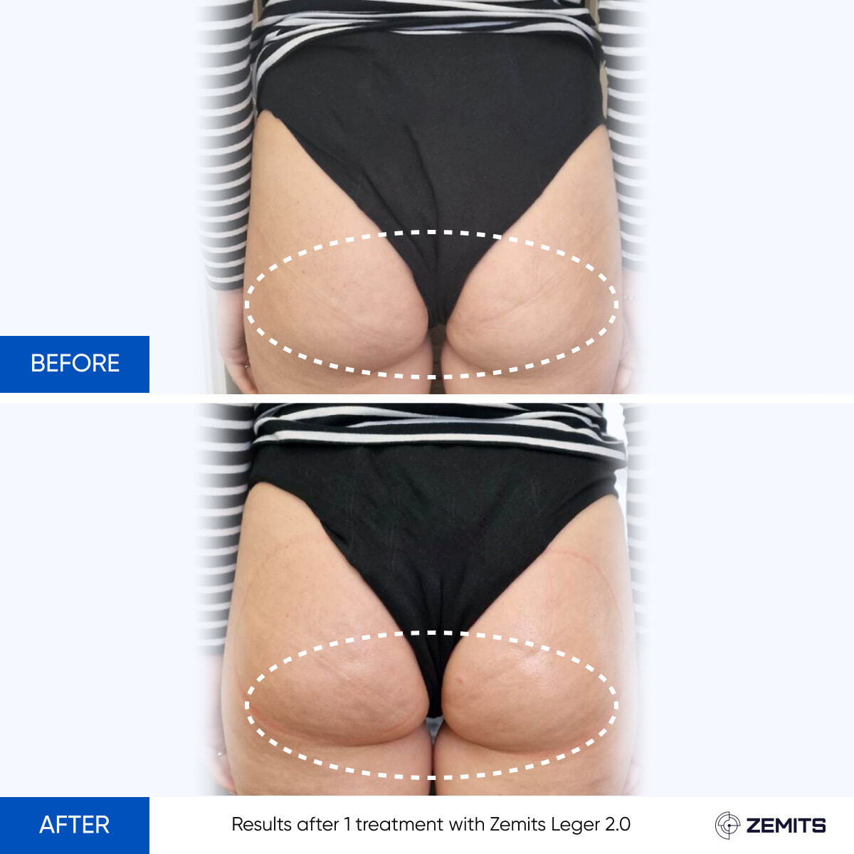 Before After Slide 2