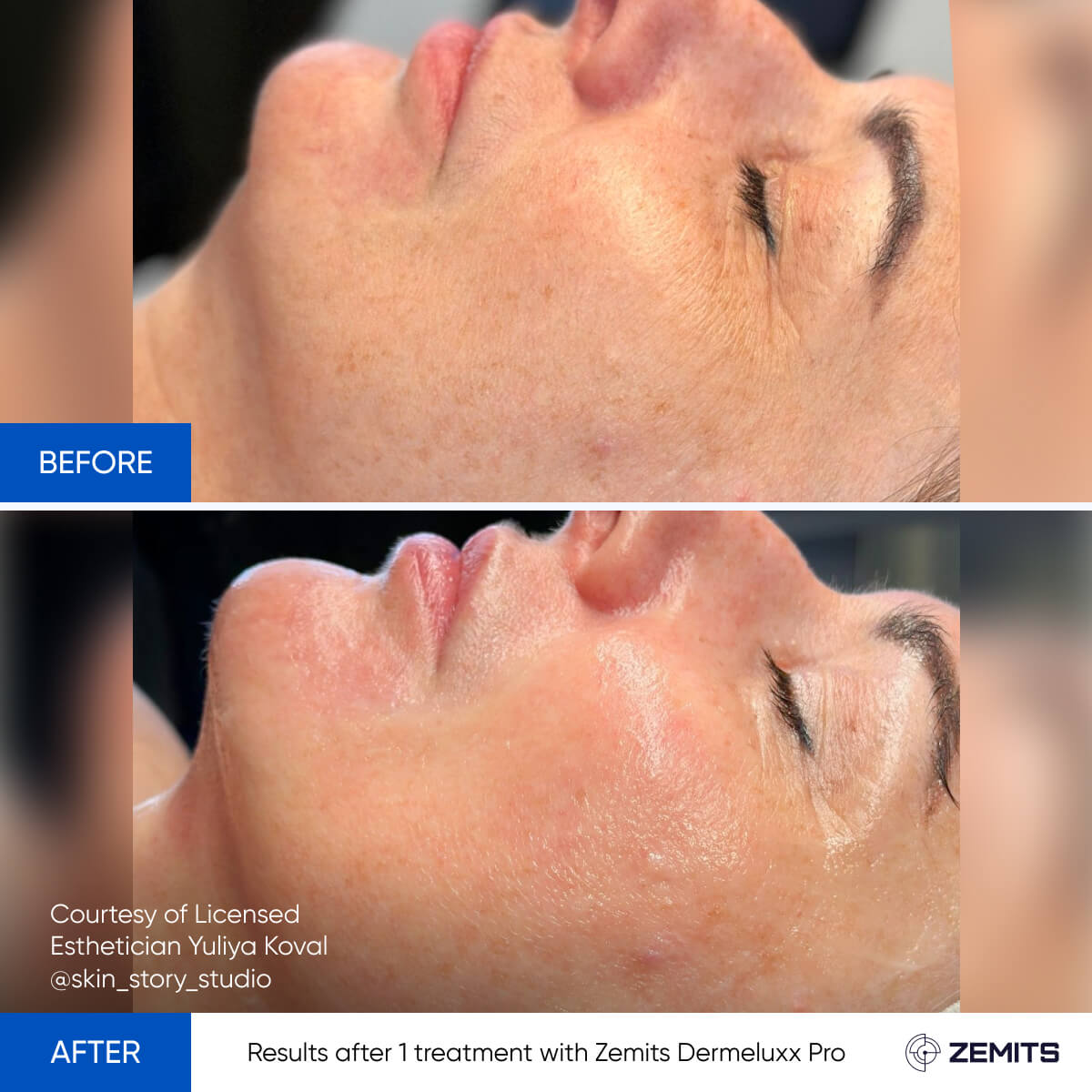 Before After Slide 22