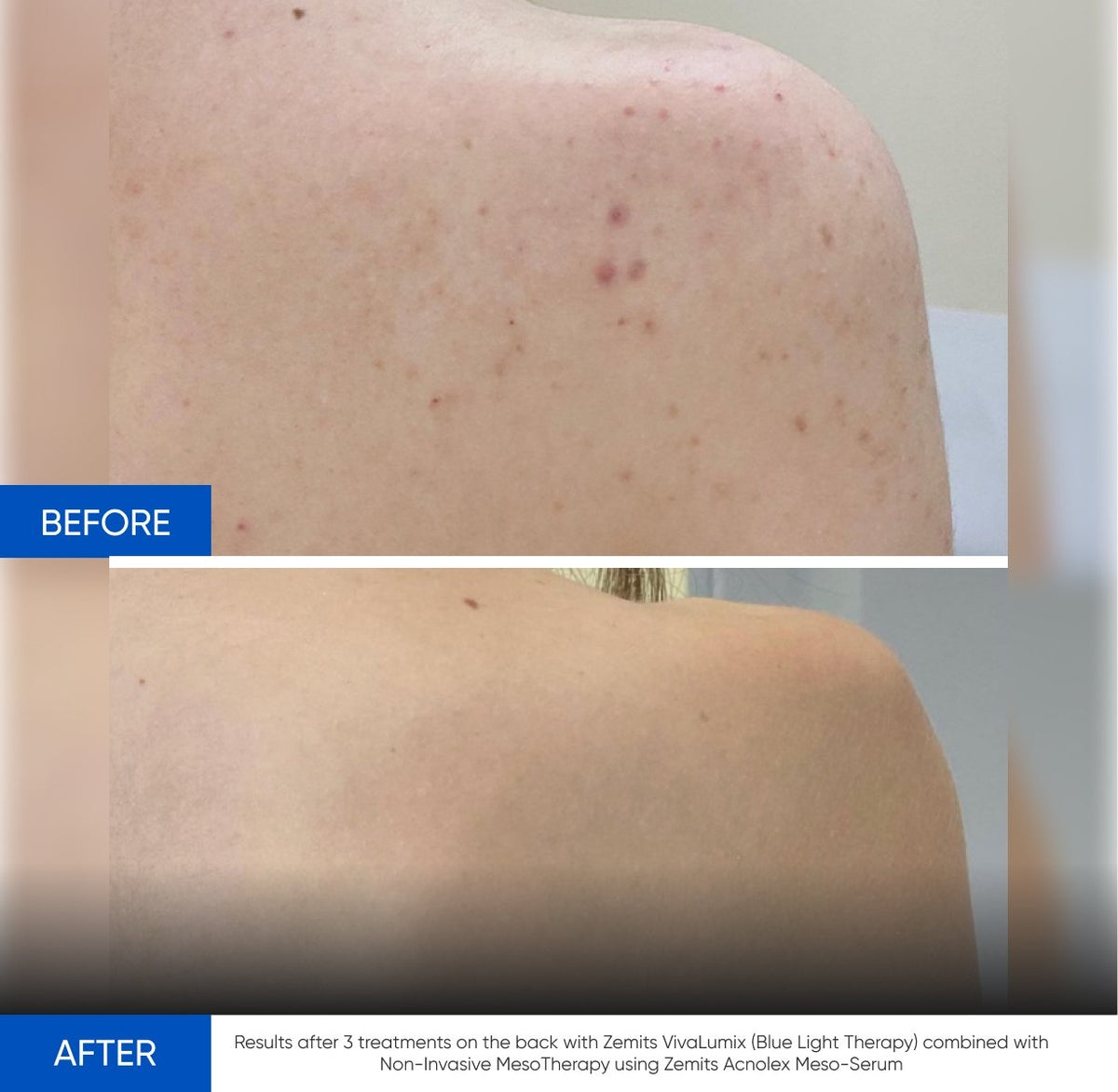 Before After Slide 1