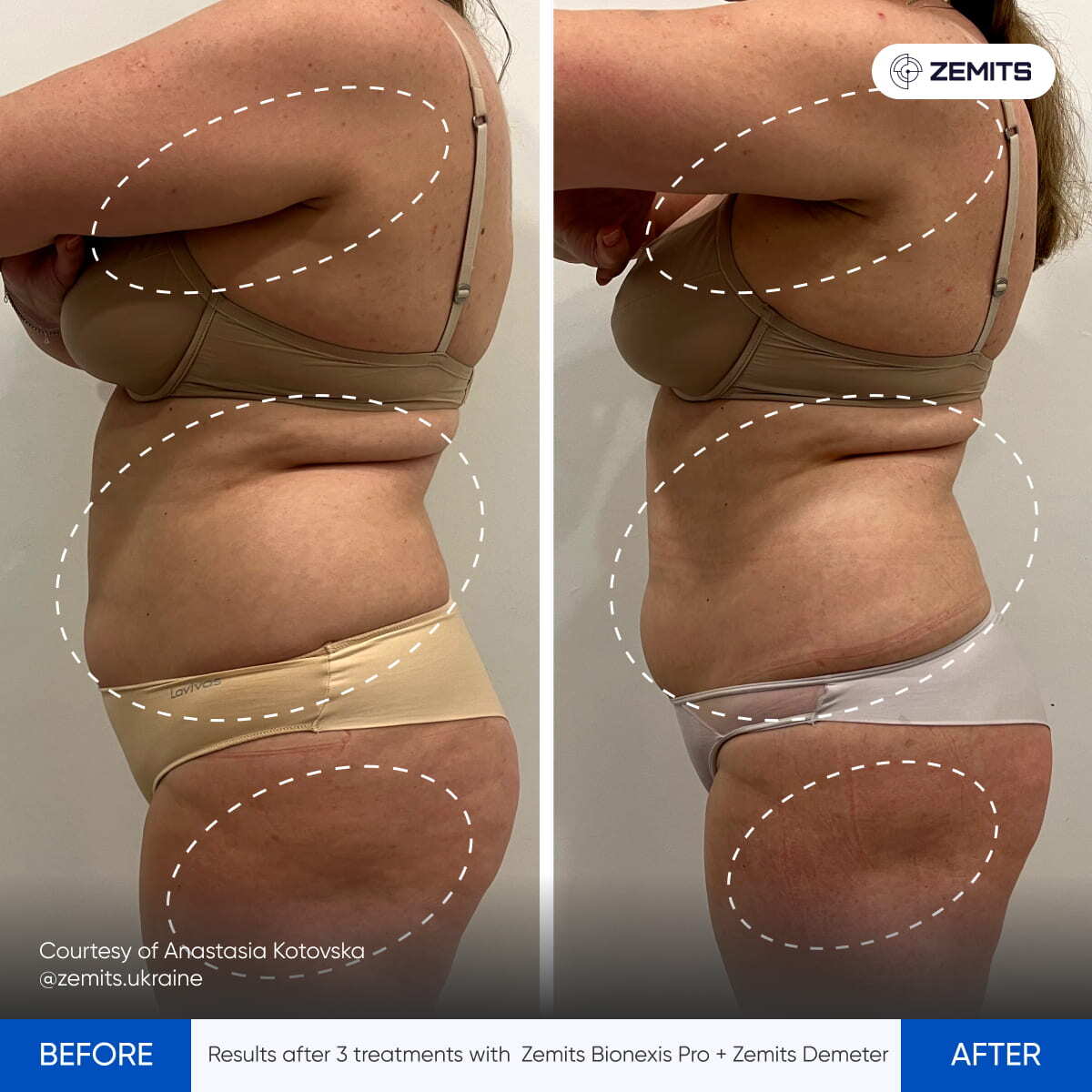 Before After Slide 13