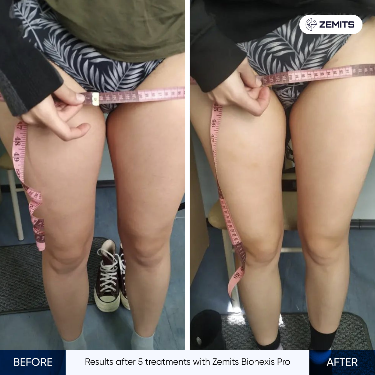 Before After Slide 6