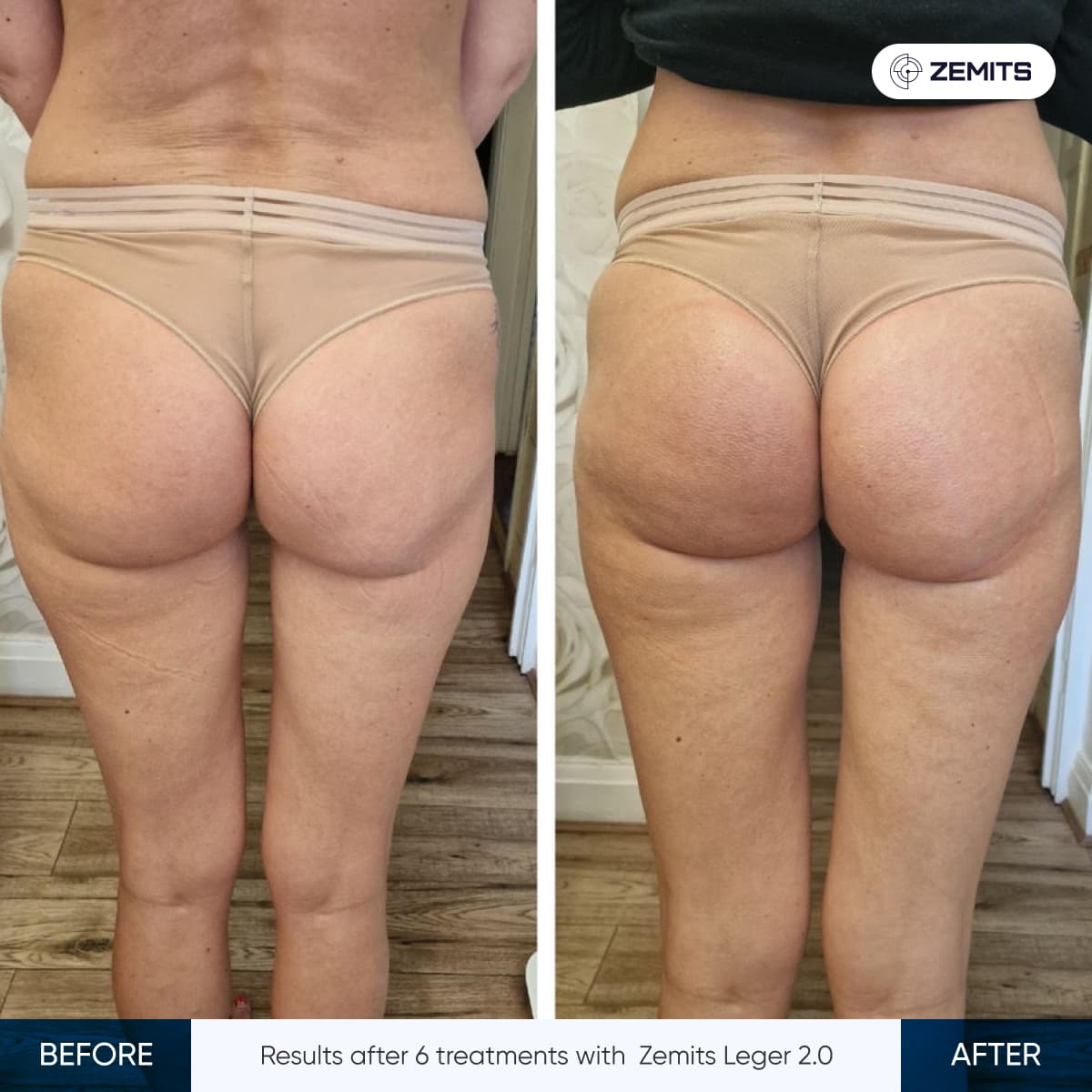 Before After Slide 4