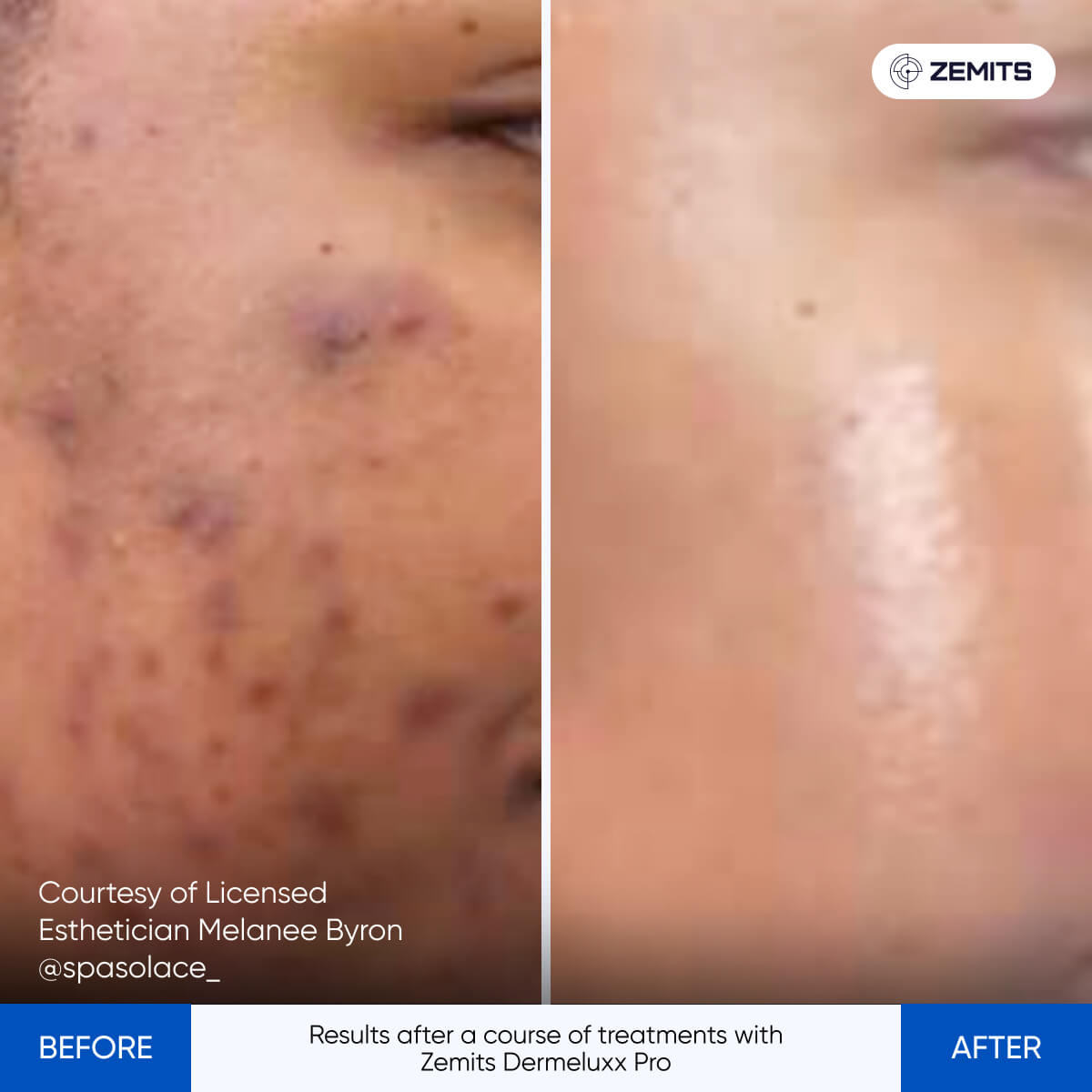 Before After Slide 11