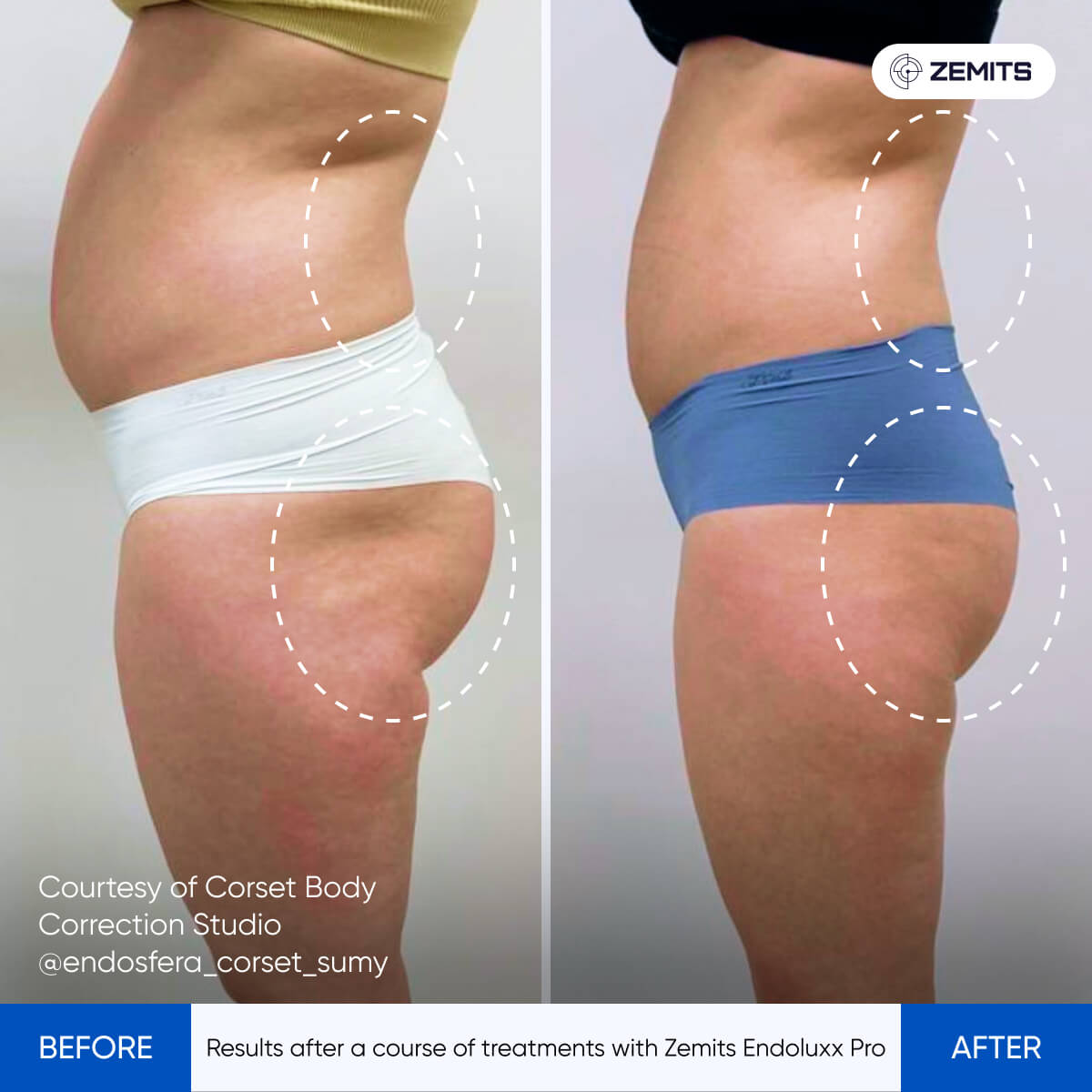 Before After Slide 4