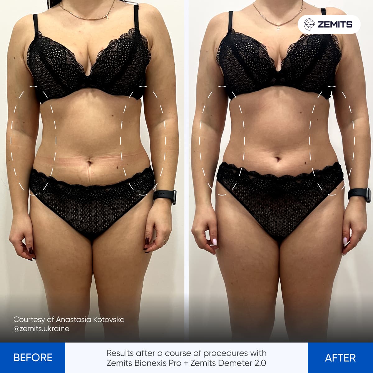 Before After Slide 14