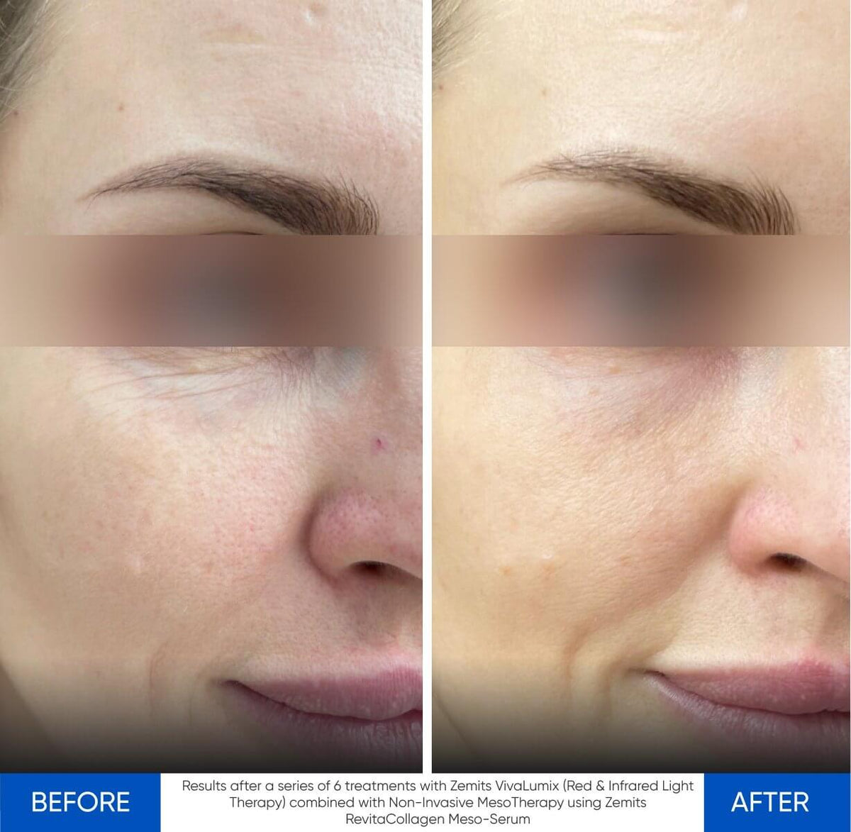 Before After Slide 3