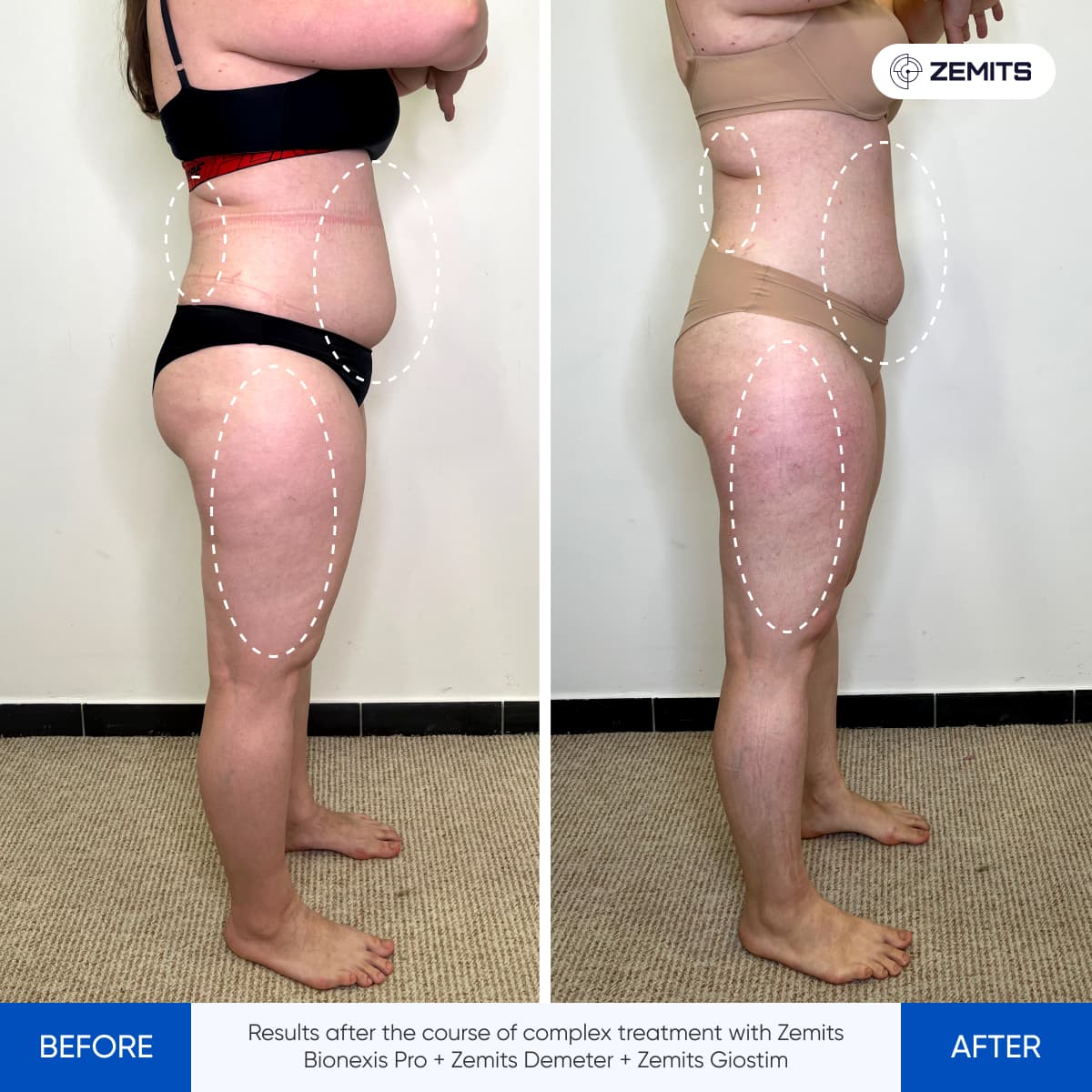 Before After Slide 12