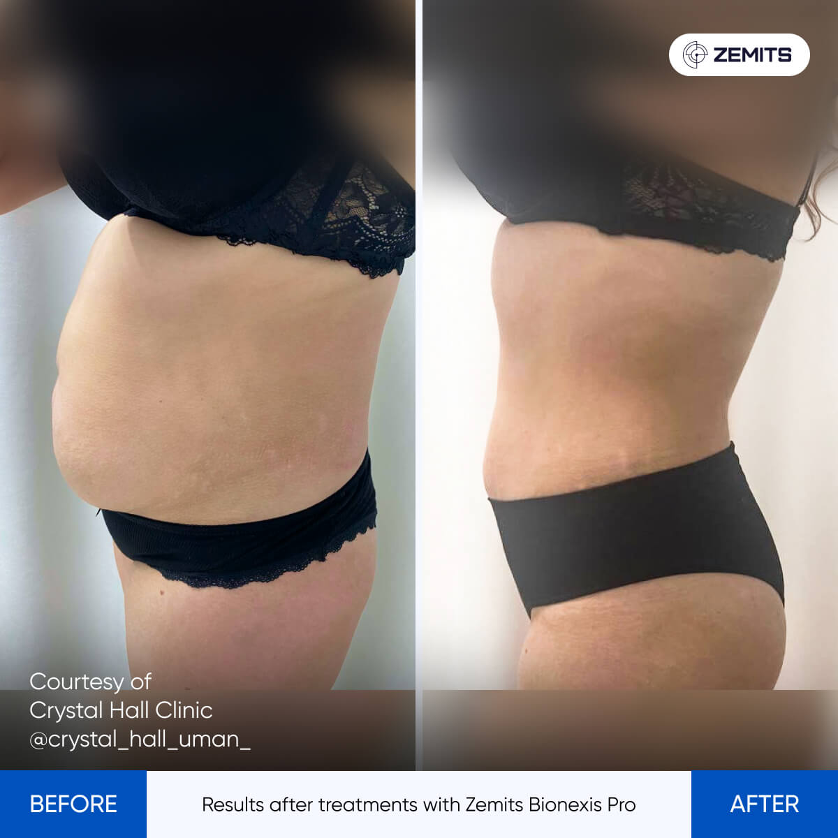 Before After Slide 1