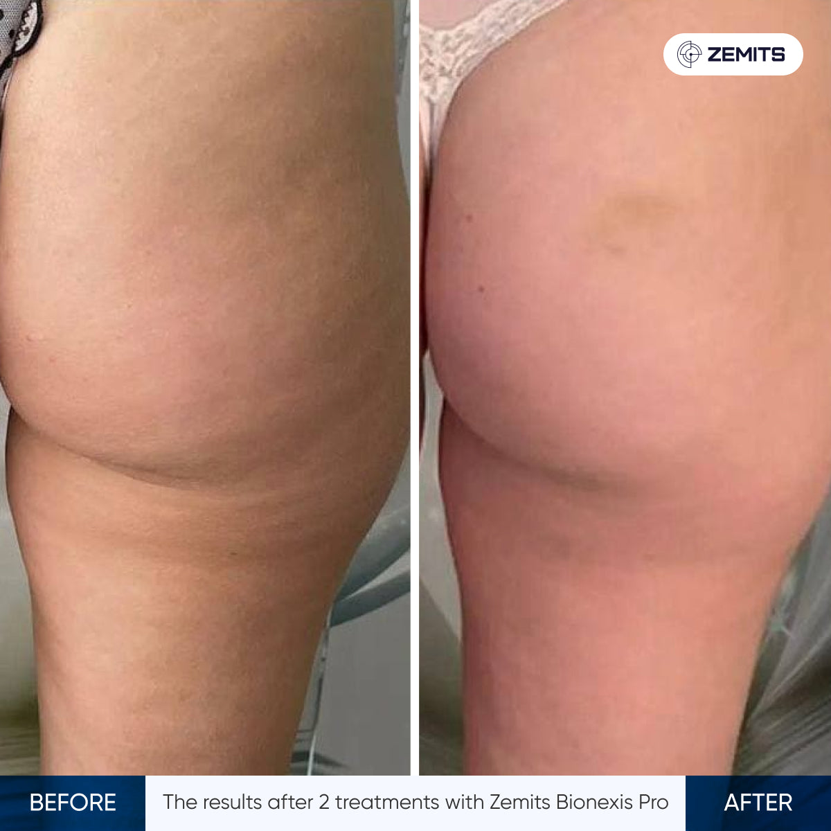 Before After Slide 7