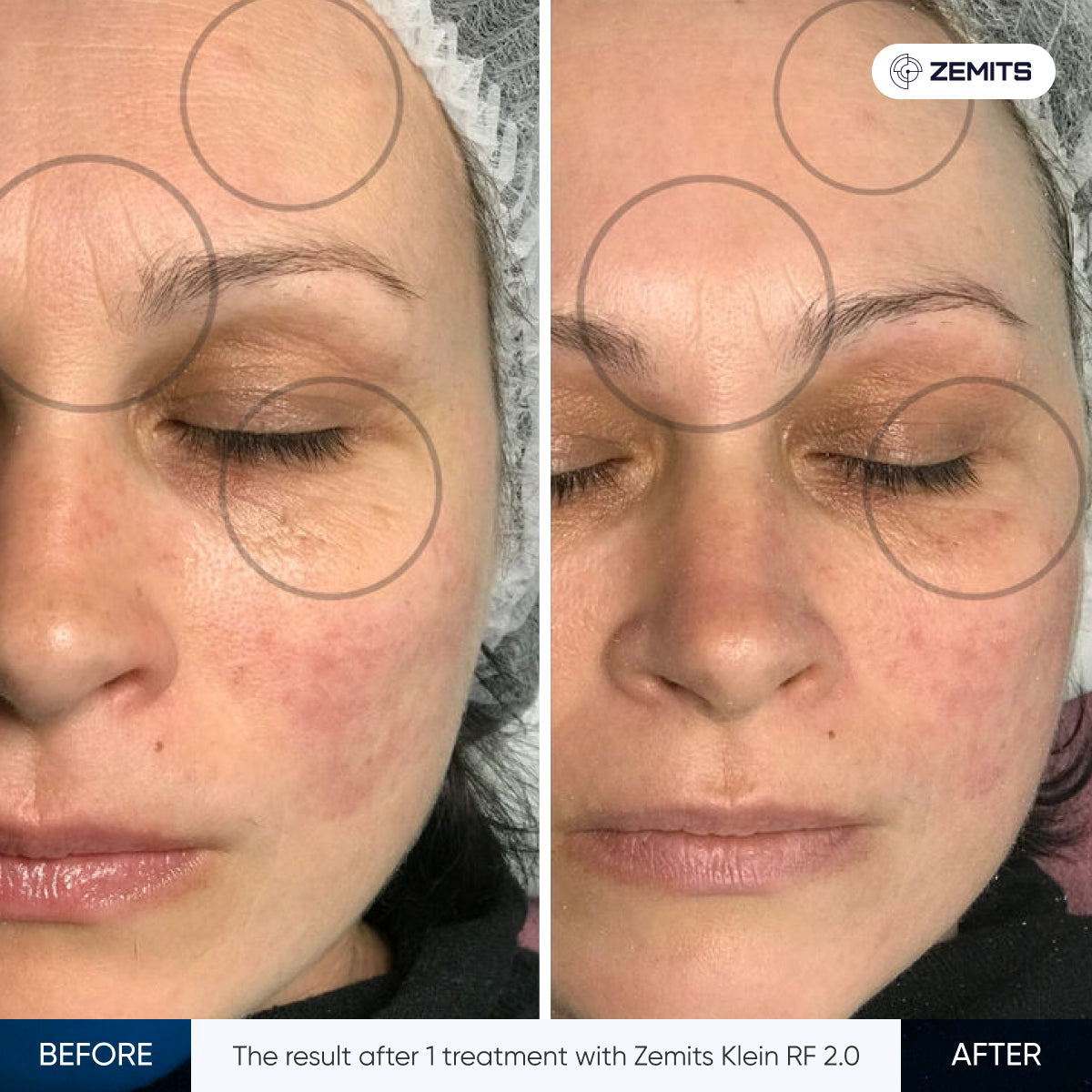 Before After Slide 2