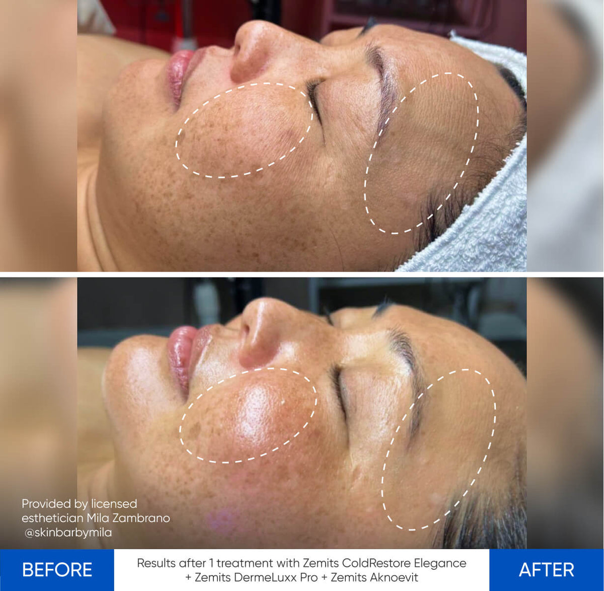 Before After Slide 1