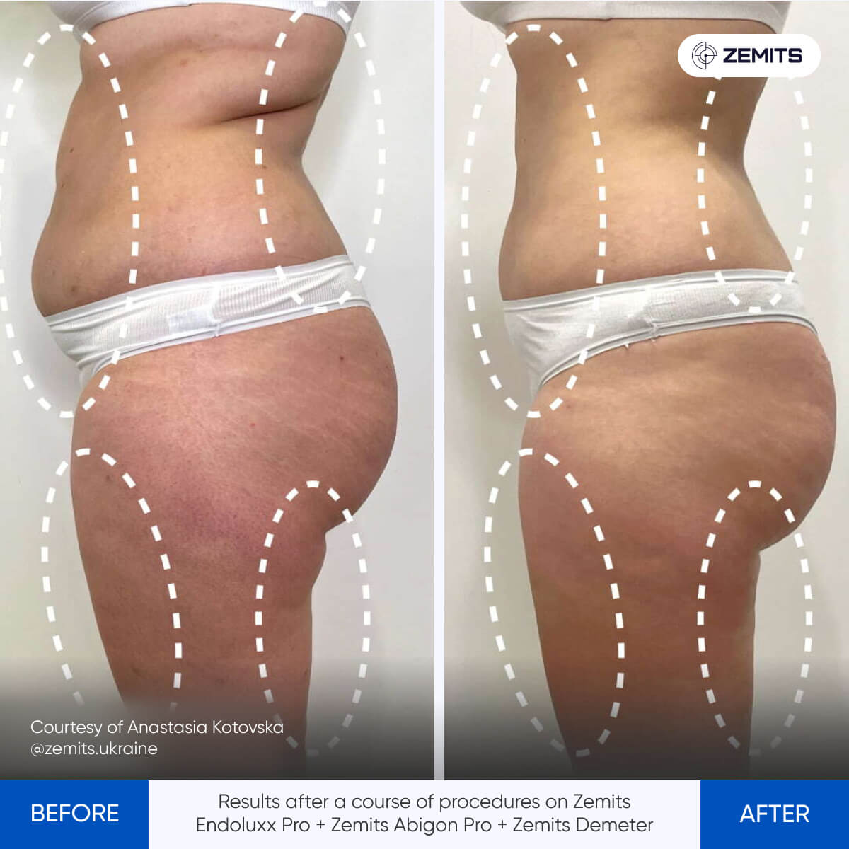 Before After Slide 4