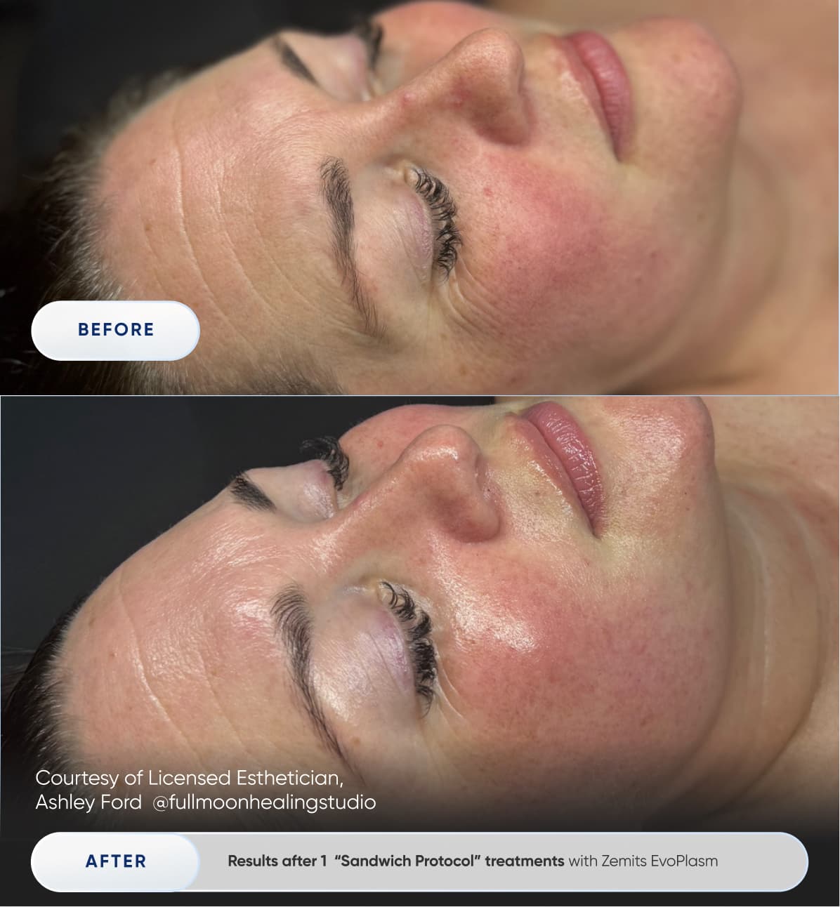 Before After Slide 5