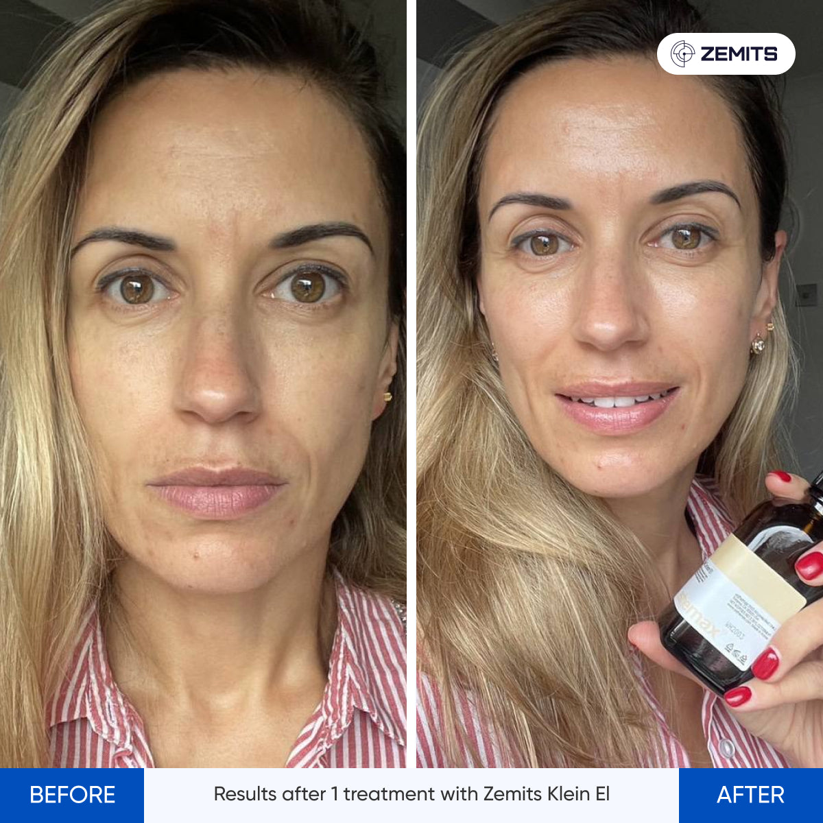 Before After Slide 5
