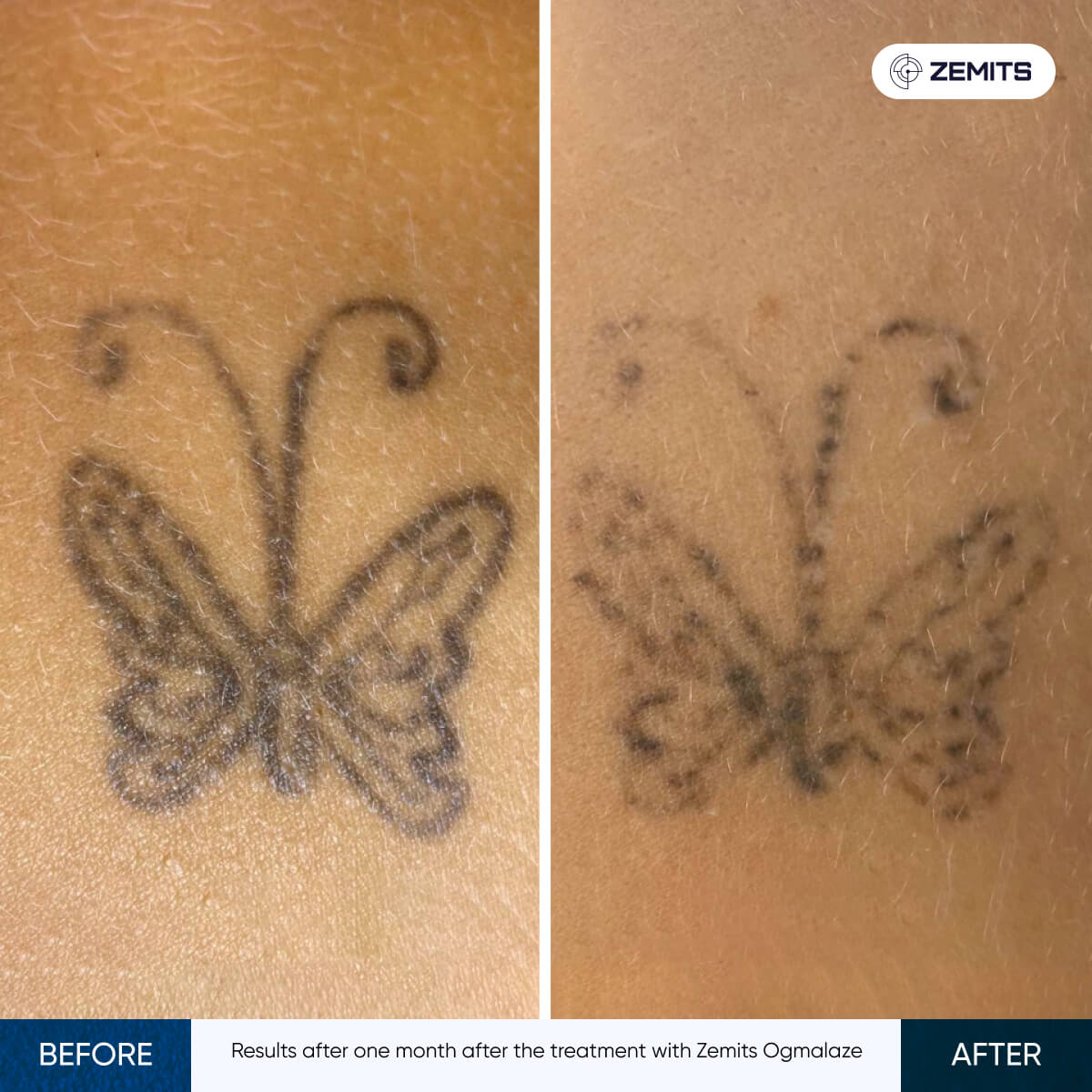 Before After Slide 7