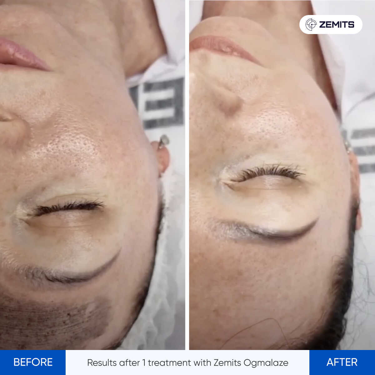 Before After Slide 6