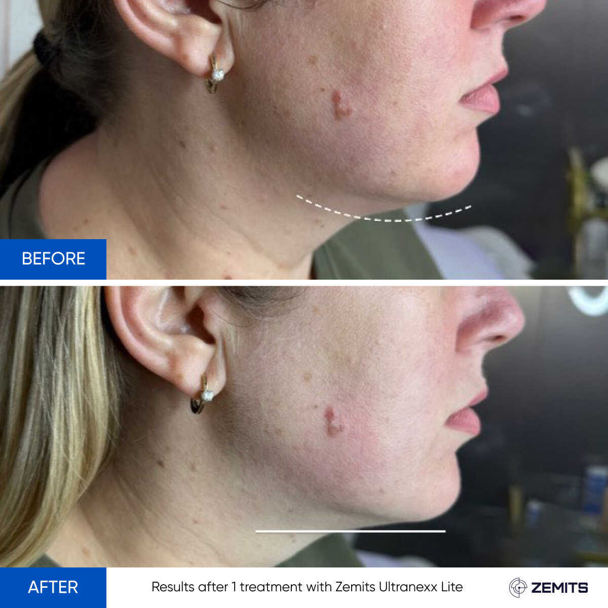 Before After Slide 7