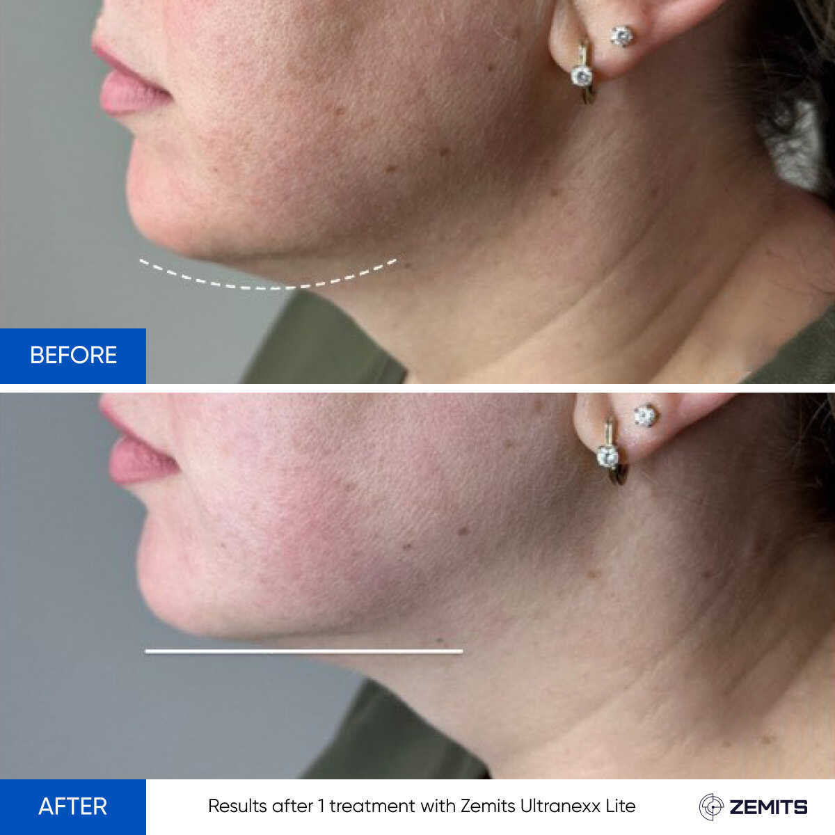 Before After Slide 8